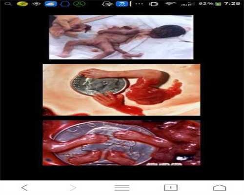 AppleWatch+智能胎心仪，孕期提醒布局智慧母婴