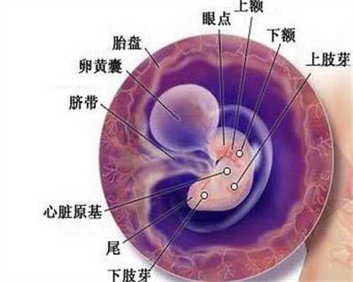 深圳个人代孕：附件炎对助孕会造成影响吗