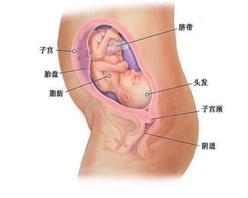 北京圆梦天使代孕公司：台州附件炎对于女性的