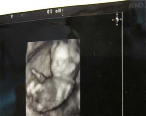 助孕7个月胎儿图1