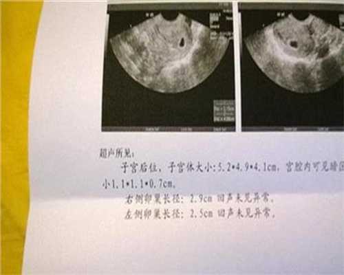 孕妇附件炎怎么办：上海私立医院产子