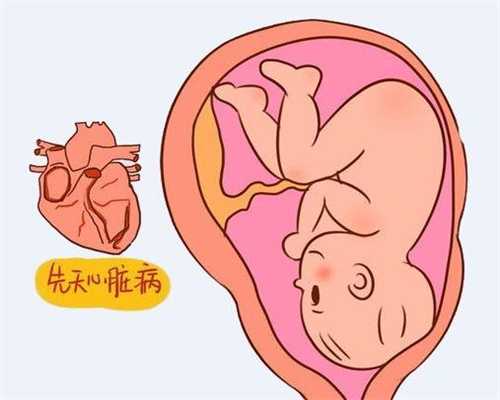 子宫后位代孕有什么好处广州助孕