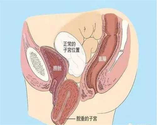 人工受精北京专业代孕机构