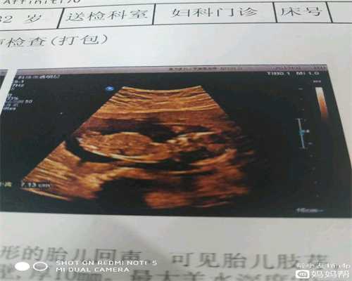 广州借卵子生子的成功率,广州代孕对小孩有影响