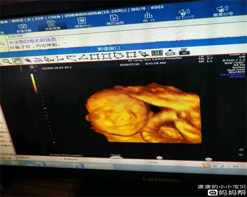 广州借卵子试管婴儿移植后,精子卵子存活时间