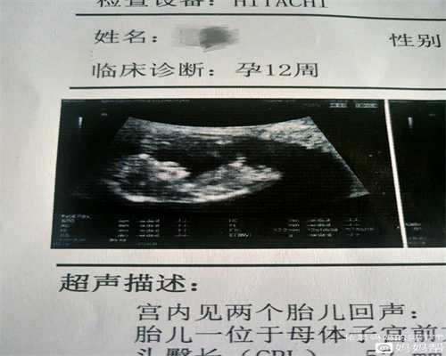 西藏借卵子生子有什么规定~西藏找代孕中介电话
