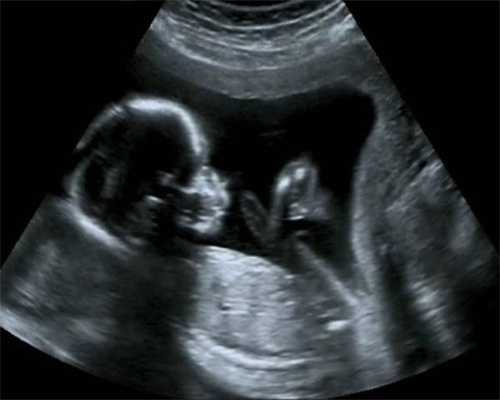 输卵管峡部最狭窄-美国试管婴儿胎教故事280个必