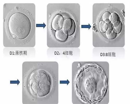 广州代孕价格,广州借卵生子流程顺产侧切的好处