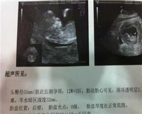 广州代孕正规机构-广州找代孕合法吗-广州代孕产
