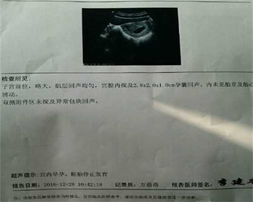 广州试管代孕-广州代孕哪家便宜-广州代孕最新法