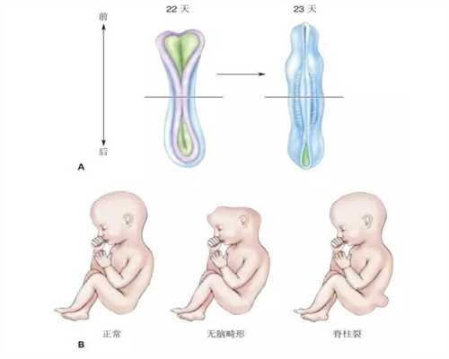 广州代生子-广州代怀孕三甲医院-广州代生孩子联