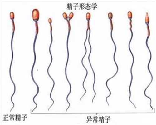 广州代生双胞胎代孕价格-人工广州代孕要花多少