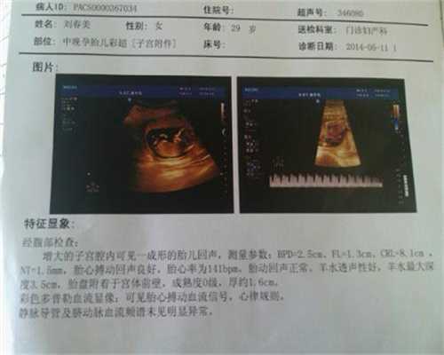 广州代孕-广州哪有代孕-广州代孕试管婴儿网站