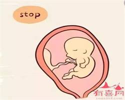 广州代孕生子多少钱-广州代孕费用高吗-广州找个女人代孕要多少钱